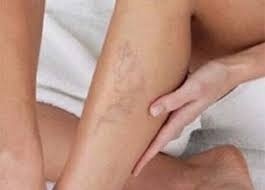 Is Quadrivas Therapy geschikt voor mij? image 1